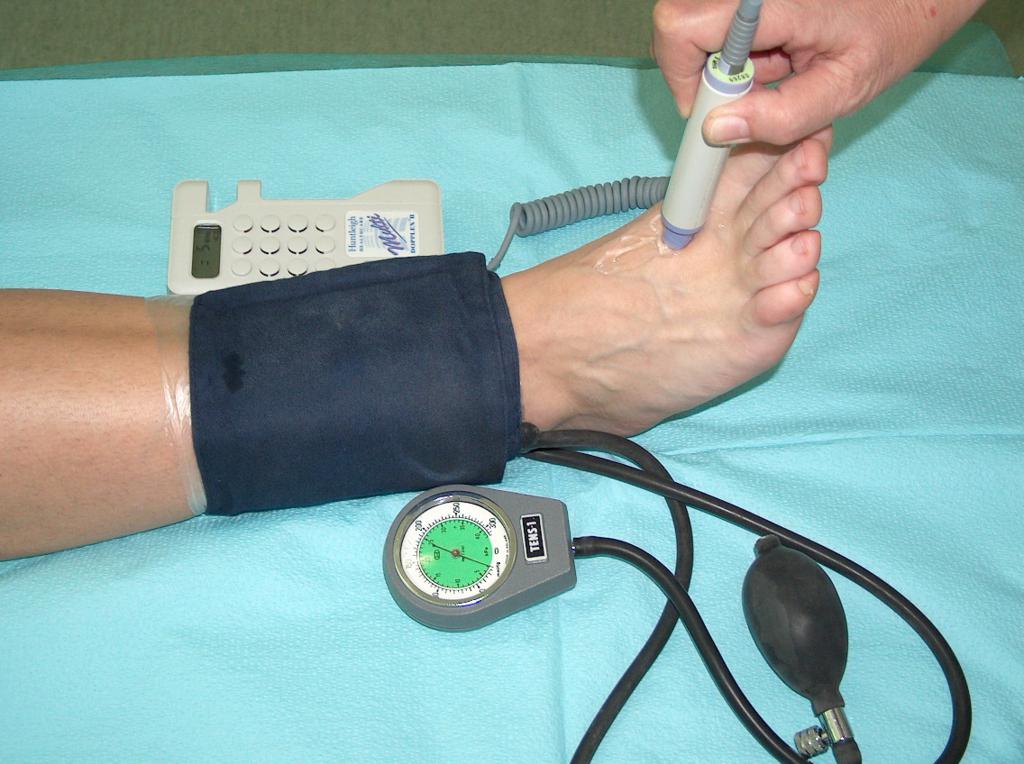 Fot. 7. Messung von Knöchel-Arm-Index (eigenes Archiv der Autorin)